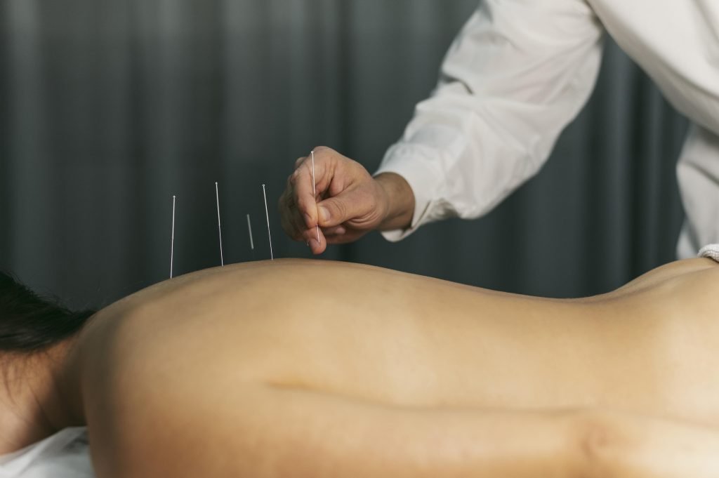Acupuncturist in Barendrecht